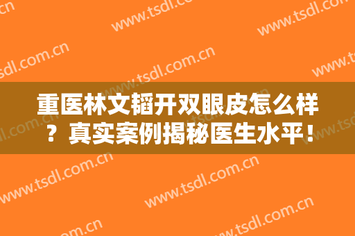 重医林文韬开双眼皮怎么样？真实案例揭秘医生水平！这篇功课别错过~