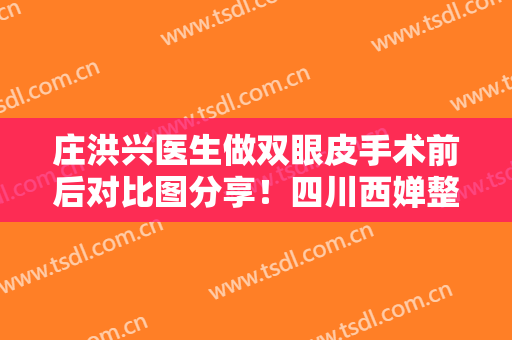 庄洪兴医生做双眼皮手术前后对比图分享！四川西婵整形医院概况及价格表分享！