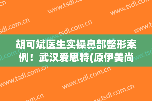 胡可斌医生实操鼻部整形案例！武汉爱思特(原伊美尚)口碑好吗？