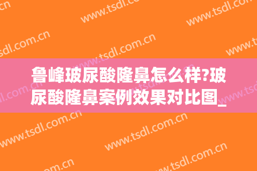 鲁峰玻尿酸隆鼻怎么样?玻尿酸隆鼻案例效果对比图_南方医科大学南方医院