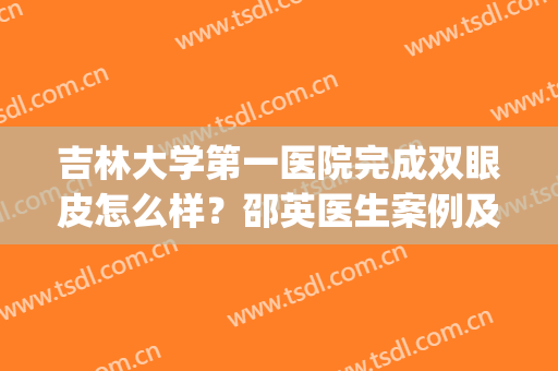 吉林大学第一医院完成双眼皮怎么样？邵英医生案例及价格超全分享！(吉林大学第一医院整形科邵英)
