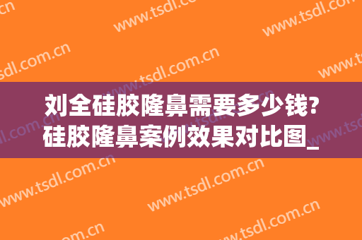 刘全硅胶隆鼻需要多少钱?硅胶隆鼻案例效果对比图_四川省医学科学院·四川省人民医院