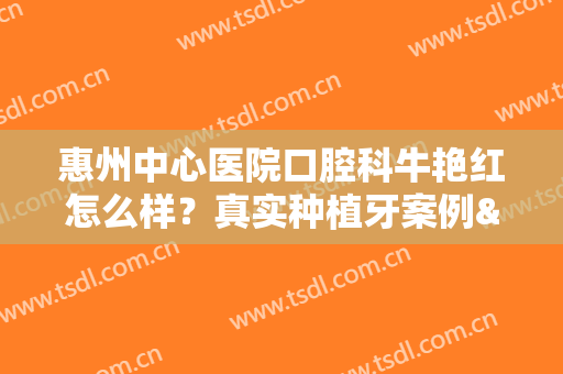 惠州中心医院口腔科牛艳红怎么样？真实种植牙案例&价格表2024
