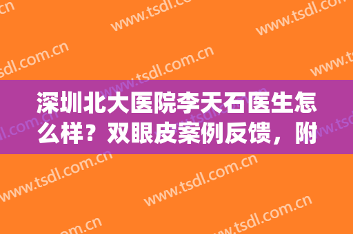 深圳北大医院李天石医生怎么样？双眼皮案例反馈，附手术价格表！(深圳北大医院做双眼皮最好的医生)