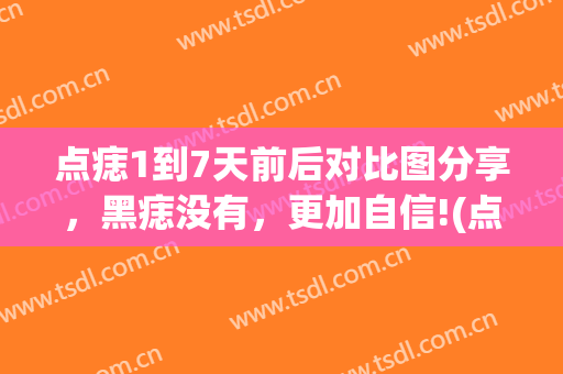 点痣1到7天前后对比图分享，黑痣没有，更加自信!(点痣后两三天的图片)