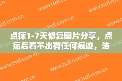 点痣1-7天修复图片分享，点痣后看不出有任何痕迹，洁白的皮肤让人羡慕!