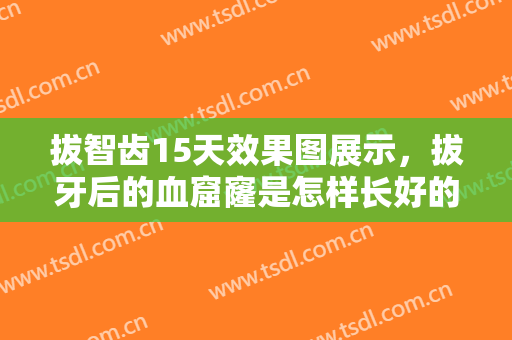 拔智齿15天效果图展示，拔牙后的血窟窿是怎样长好的呢?看一下恢复图就能秒懂!