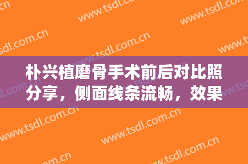 朴兴植磨骨手术前后对比照分享，侧面线条流畅，效果绝绝子(朴兴植颧骨做得好吗)