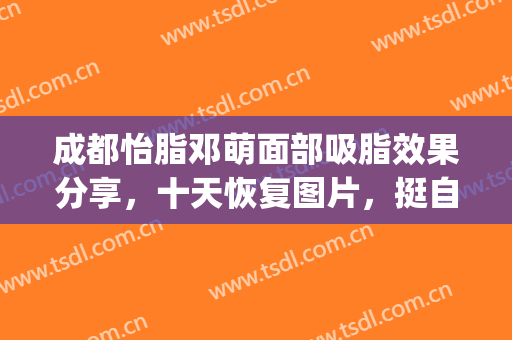 成都怡脂邓萌面部吸脂效果分享，十天恢复图片，挺自然的！(成都面部吸脂医生)