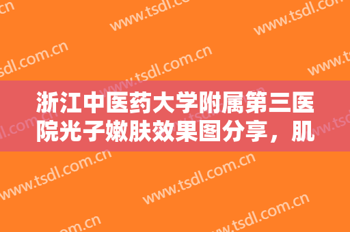 浙江中医药大学附属第三医院光子嫩肤效果图分享，肌肤瞬间提升光泽感~