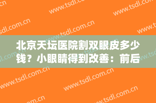 北京天坛医院割双眼皮多少钱？小眼睛得到改善：前后差别太大了！(双眼皮天花多少钱)
