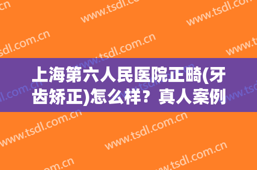 上海第六人民医院正畸(牙齿矫正)怎么样？真人案例|2024价格表