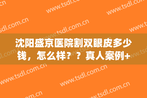 沈阳盛京医院割双眼皮多少钱，怎么样？？真人案例+价格表一览！(沈阳割双眼皮大概要价格)