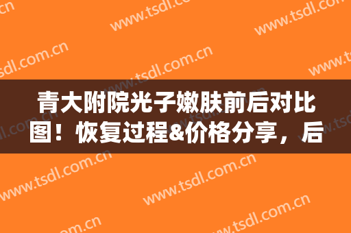 青大附院光子嫩肤前后对比图！恢复过程&价格分享，后悔没早来！(青岛青医附院光子嫩肤)