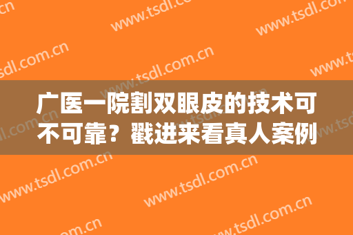 广医一院割双眼皮的技术可不可靠？戳进来看真人案例图吧(广州哪个医生双眼皮做的好)