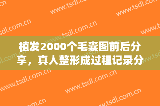 植发2000个毛囊图前后分享，真人整形成过程记录分享|亲测效果不错，值得分享!