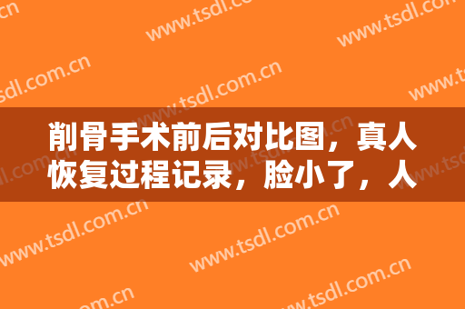 削骨手术前后对比图，真人恢复过程记录，脸小了，人也更漂亮，和大脸盘子彻底说拜拜!