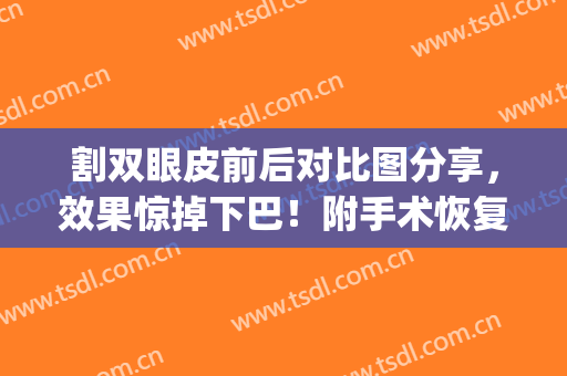 割双眼皮前后对比图分享，效果惊掉下巴！附手术恢复过程~(割双眼皮的恢复过程图)