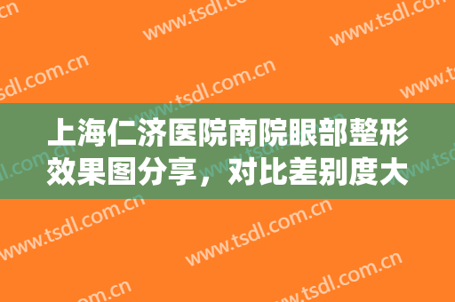 上海仁济医院南院眼部整形效果图分享，对比差别度大！(上海仁济医院眼科好吗)