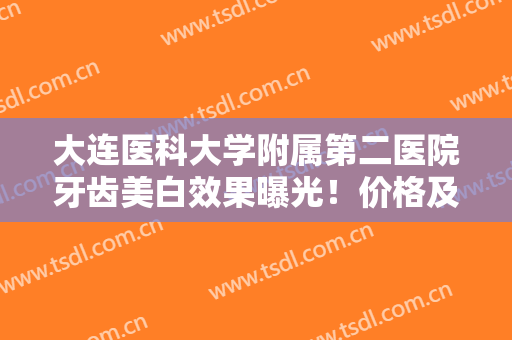 大连医科大学附属第二医院牙齿美白效果曝光！价格及简介分享，术前攻略！
