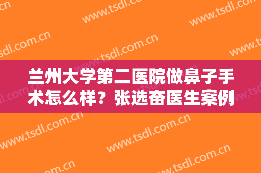 兰州大学第二医院做鼻子手术怎么样？张选奋医生案例点评，这效果爱住！