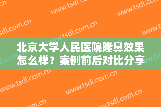 北京大学人民医院隆鼻效果怎么样？案例前后对比分享！附全新价格表~