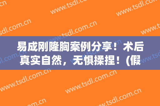 易成刚隆胸案例分享！术后真实自然，无惧揉捏！(假体隆胸失败案例)