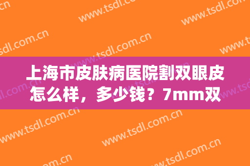 上海市皮肤病医院割双眼皮怎么样，多少钱？7mm双眼皮简直太美！戳进来get~