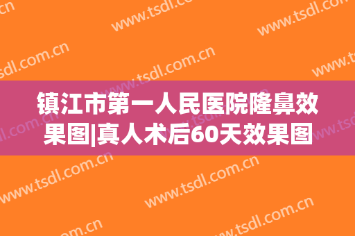 镇江市第一人民医院隆鼻效果图|真人术后60天效果图反馈！附收费价格~