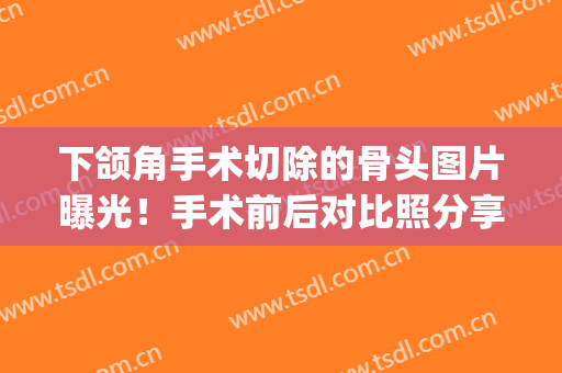 下颌角手术切除的骨头图片曝光！手术前后对比照分享，变化好大(下颌角切下来的骨头)