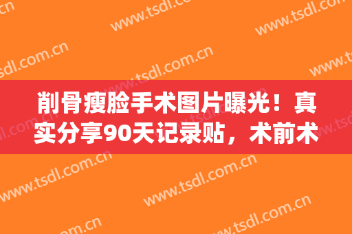 削骨瘦脸手术图片曝光！真实分享90天记录贴，术前术后全过程指南~(削骨瘦脸手术怎么做)