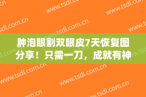 肿泡眼割双眼皮7天恢复图分享！只需一刀，成就有神双眸！(肿眼泡割双眼皮恢复多久)