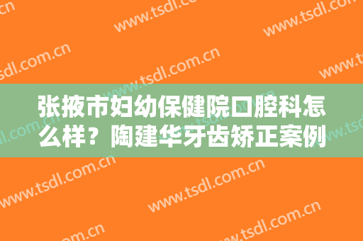 张掖市妇幼保健院口腔科怎么样？陶建华牙齿矫正案例&价格表公开！