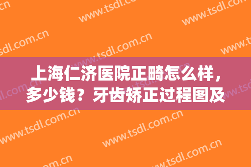上海仁济医院正畸怎么样，多少钱？牙齿矫正过程图及收费情况曝光！(上海同仁医院牙齿矫正多少钱)