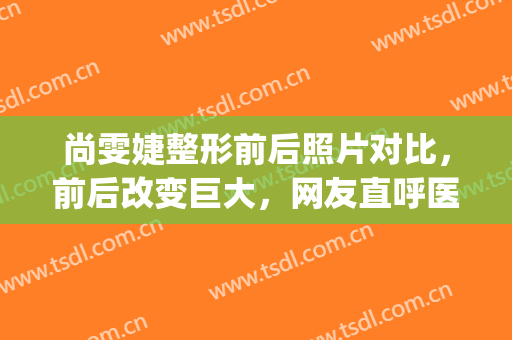 尚雯婕整形前后照片对比，前后改变巨大，网友直呼医美换头牛掰！(尚雯婕容貌变化)