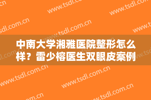 中南大学湘雅医院整形怎么样？雷少榕医生双眼皮案例公开，附价格表！