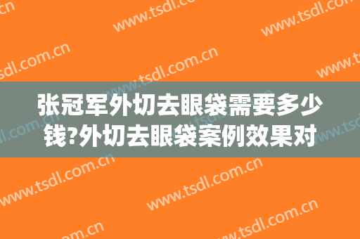 张冠军外切去眼袋需要多少钱?外切去眼袋案例效果对比图_济南市中心医院