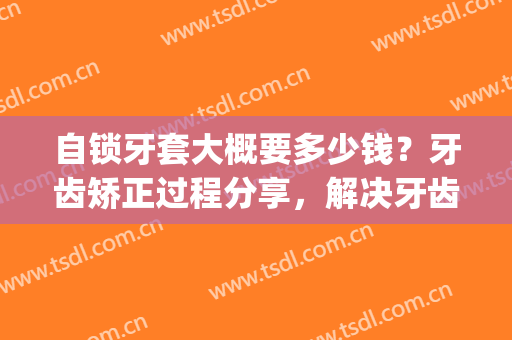 自锁牙套大概要多少钱？牙齿矫正过程分享，解决牙齿不齐嘴凸(自锁牙套矫正龅牙多久有效果)