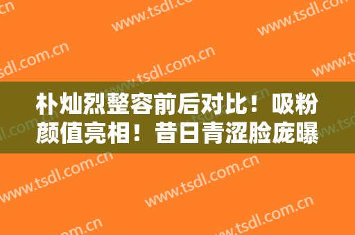朴灿烈整容前后对比！吸粉颜值亮相！昔日青涩脸庞曝光，粉丝直呼惊讶！