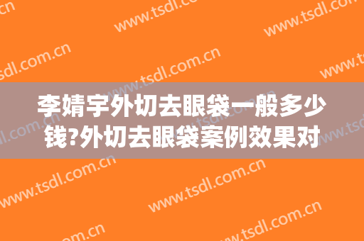 李婧宇外切去眼袋一般多少钱?外切去眼袋案例效果对比图_浙江省人民医院
