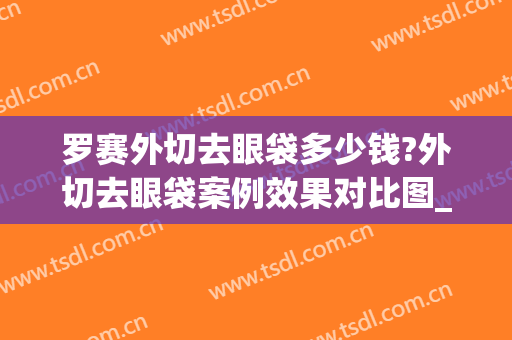 罗赛外切去眼袋多少钱?外切去眼袋案例效果对比图_哈尔滨医科大学附属第一医院