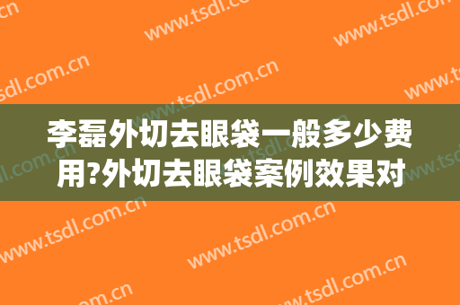 李磊外切去眼袋一般多少费用?外切去眼袋案例效果对比图_海南省人民医院