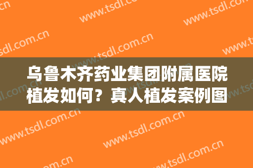 乌鲁木齐药业集团附属医院植发如何？真人植发案例图|价格表2024新版