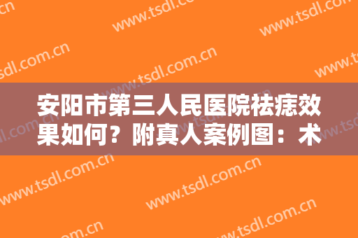 安阳市第三人民医院祛痣效果如何？附真人案例图：术后效果真心不错！