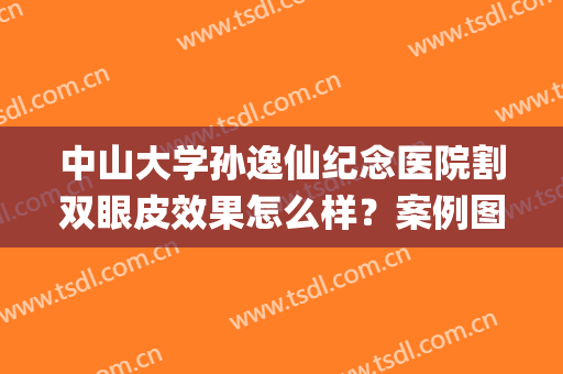 中山大学孙逸仙纪念医院割双眼皮效果怎么样？案例图_价格表2024版曝光！