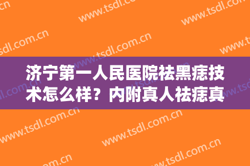 济宁第一人民医院祛黑痣技术怎么样？内附真人祛痣真实效果图分享(济宁人民医院点痣多少钱)
