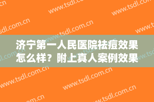济宁第一人民医院祛痘效果怎么样？附上真人案例效果图分享(济宁人民医院激光祛痘)