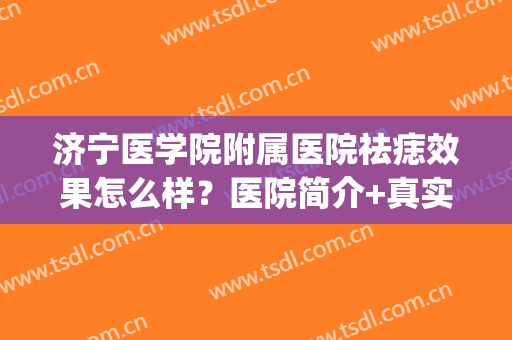 济宁医学院附属医院祛痣效果怎么样？医院简介+真实效果图+价格表(济宁附属和人民激光点痣哪家好)
