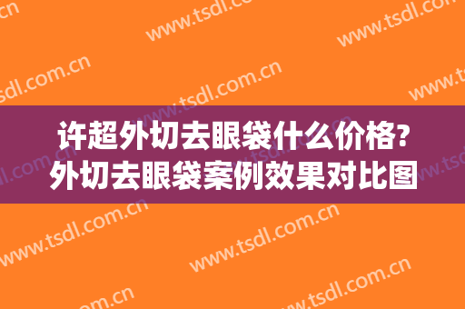 许超外切去眼袋什么价格?外切去眼袋案例效果对比图_淄博市中心医院