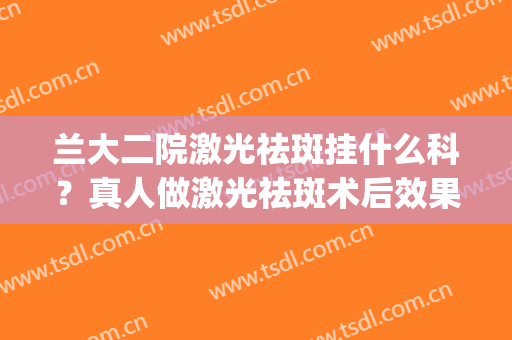 兰大二院激光祛斑挂什么科？真人做激光祛斑术后效果来袭，好明显(兰大二院激光祛痘)